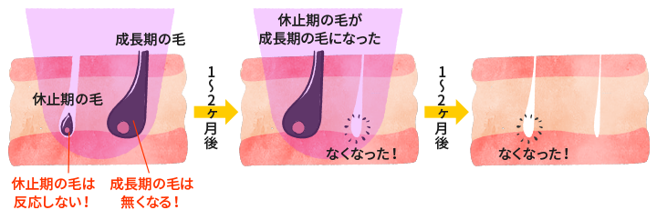 毛周期イメージ